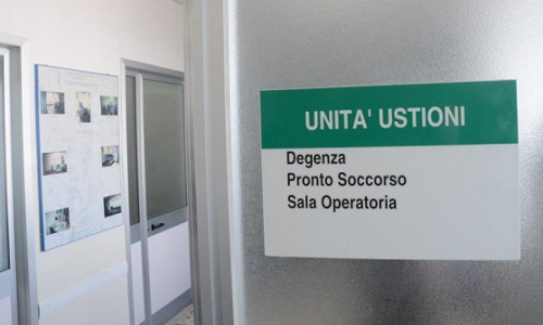 Lecce, incidente sul lavoro: ustionati tre operai